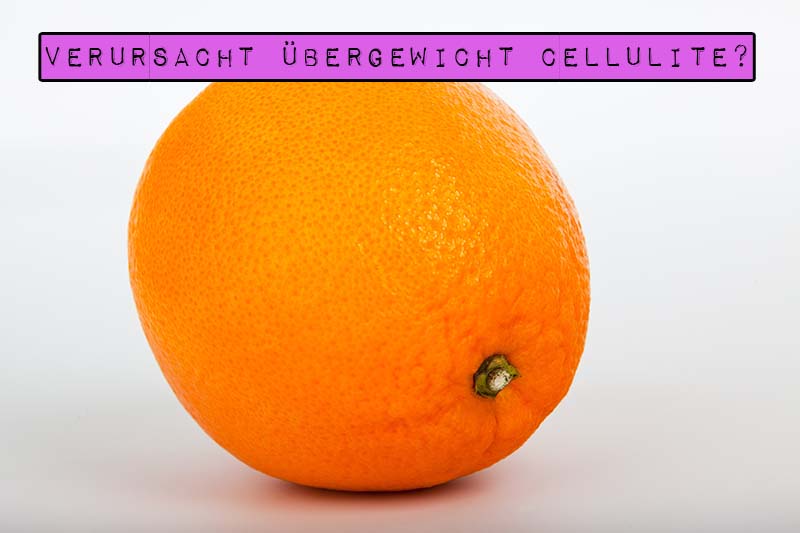 Marshmallow Mädchen verrät die Wahrheit über Orangenhaut und beantwortet die Frage: Verursacht Übergewicht Cellulite?