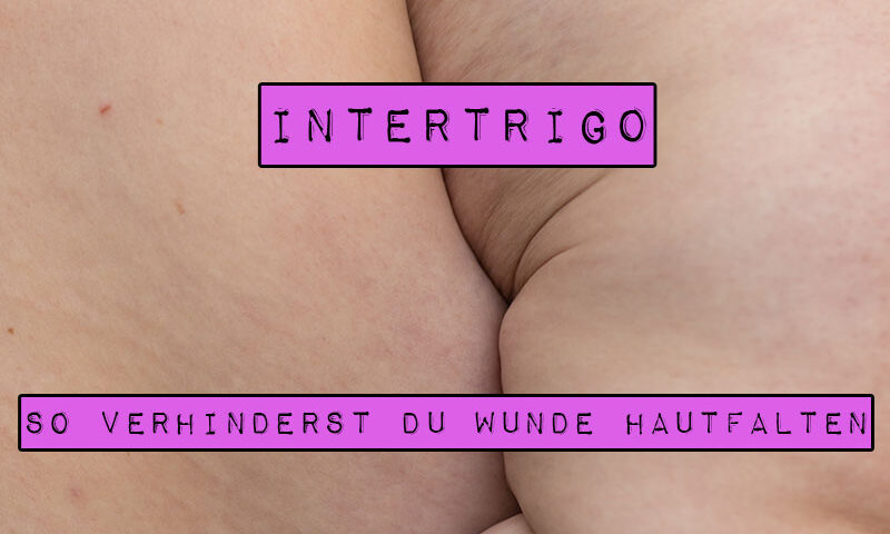 Vor allem dicke Menschen leiden unter wunden Hautfalten, etwa wenn sich eine Bauchfalte entzündet. Aber auch Frauen mit großen Brüsten kennen das schmerzhafte Wundreiben in der Brustfalte. Doch gegen eine sogenannte Intertrigo kannst du etwas tun. Marshmallow Mädchen stellt dir einfache Mittel vor, mit denen du wunde Hautfalten verhindern und behandeln kannst.
